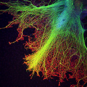Dr. Juan Carlos Izpisúa, Center of Regenerative Medicine in Barcelona (CMRB)
Neurons growing over astrocytes in a human stem cell embryo body