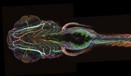Ventral view of a Tau transgenic zebrafish stained for the neuronal protein tubulin (in green), human Tau (in red), and disease-modified human Tau (in blue)