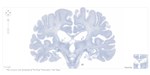 Histological view of section #1279. The Brain Atlas uses Google Maps technology to navigate the high-resolution images of H.M.’s brain. 