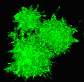 A 3-D reconstruction of three ASC specks