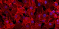 image: Growing New Neurons