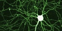 image: Stem Cells Myelinate Human Brain