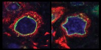 image: New Culprit for Parkinson’s?