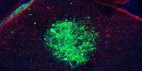 image: Stem Cells Not Needed for Cancer