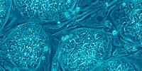 image: Viruses Affect Cell Reprogramming