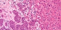 image: A Window into Cancer