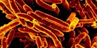 image: Metabolomics Sheds Light on TB Drug