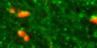 image: A Root Cause of Parkinson’s