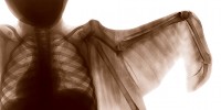 image: Anatomical Mashups