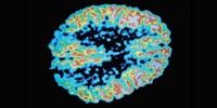 image: Metabolism and the Brain