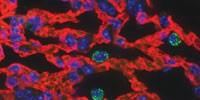 image: Waking Cancer Cells