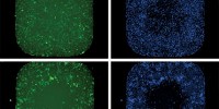 image: Capturing Crawling Cells