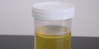 image: From Urine to Neurons