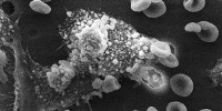 image: Texas Cancer Institute in Hot Water, Again