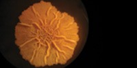image: Bacterial Sacrifice