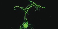 image: Neuron Preservers