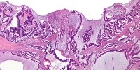 image: Cancer Biomarker Studies Retracted