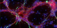 image: Debate Over Stem Cell Effectiveness
