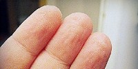 image: The Reason for Wrinkled Fingers