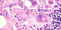 image: Non-coding Mutations May Drive Cancer