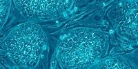 image: Stem Cells Not Rejected