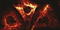 image: Next Generation: Dynamic, Nanoscale GFP