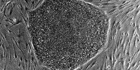 image: Stem-Cell Clinic Moves to Mexico