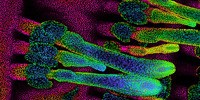 image: Image of the Day: 'Goose Bump' Muscles