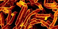 image: Stem Cells: Safe Haven For TB
