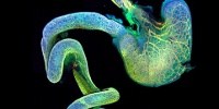image: Image of the Day: Glowing Gut