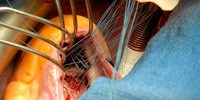 image: Image of the Day: Fixing a Broken Ticker