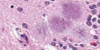image: Prions Involved in Learning