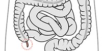 image: Appendix Not Totally Useless