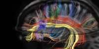image: Image of the Day: Brain Wiring
