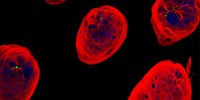 image: Image of the Day: Intestinal Ingress