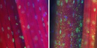 image: Prion-like Proteins Cause Disease