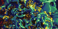 image: Mississippi Infant Cured of HIV?