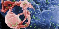 image: HIV Remission for 14 Patients