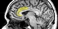 image: Brain Activity Predicts Re-arrest