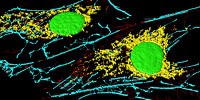 image: Image of the Day: Connective Tissue Cells