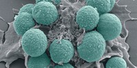 image: Image of the Day: Immune System at Work