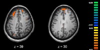 image: Bad Stats Plague Neuroscience