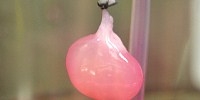 Lab-grown Kidneys Work in Rats image: Lab-grown Kidneys Work in Rats