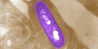 image: Tumors Fall to Radioactive Bacteria