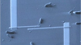 image: Electric Microbe Hairs