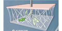 image: The Science of Acupuncture