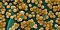 image: Re-sensitizing Resistant Bacteria