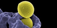 image: Image of the Day: Defense from Disease