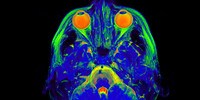 image: NIMH to Steer Away from New Manual