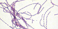 image: Selling an Anthrax Scare?